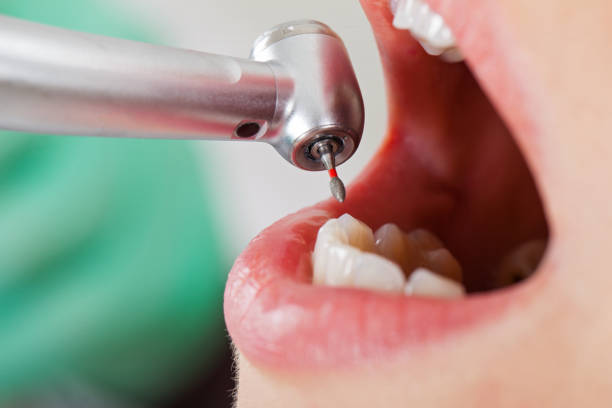 Best Pediatric Emergency Dentist in Pinckneyvle, IL
